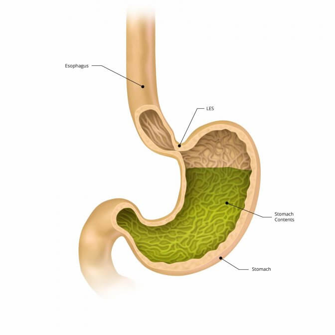 2 Positions You Should Avoid To Prevent Nighttime Heartburn