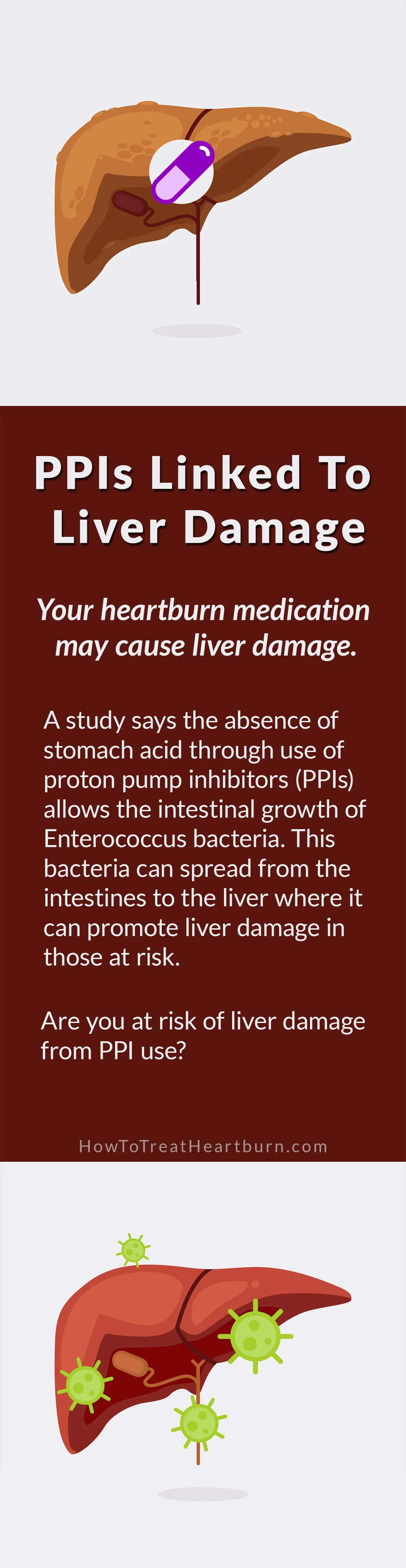 Proton Pump Inhibitors Linked To Liver Disease - How to ...