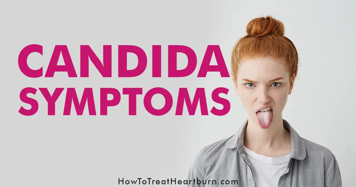 Woman showing signs of candida sticks out her white candida coated tongue.
