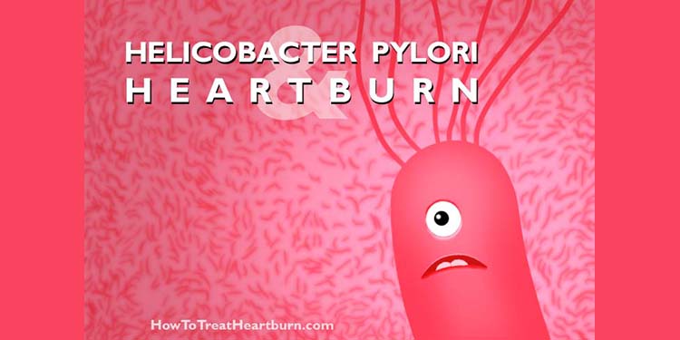 Helicobacter pylori is found in over 50% of the world's population. How does it contribute to heartburn, how it can be prevented, and how is it treated?