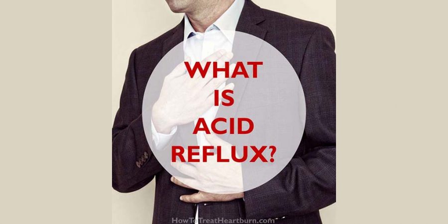 Acid reflux occurs when stomach acid backs up from the stomach into the esophagus, the tube running from the mouth to the stomach.